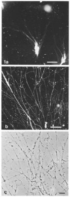  Reticulomyxa: Uma Criatura Microscópica Que Faz Redes De Si Mesma Para Caçar?!