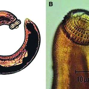  Gigantostoma Spinigerum: Um Parasita Misterioso que Vive Entre os Tecidos de Mamíferos!